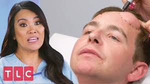 Youtube and instagram is a huge part of dr. Removing Steve S Forehead Lump Dr Pimple Popper Youtube