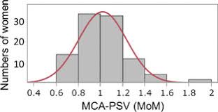 Distribution Of Mca Psv Values Transformed To Mom Among 100