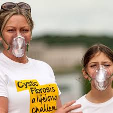 Cystic fibrosis (cf) is an inherited disorder that causes severe damage to the lungs, digestive although cystic fibrosis is progressive and requires daily care, people with cf are usually able to. Drug Maker Will Make 21bn From Treating Cystic Fibrosis Cystic Fibrosis The Guardian