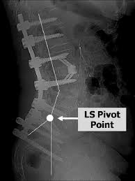 The lumbosacral pivot point is defined as the point at the middle... |  Download Scientific Diagram
