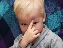 Mon Enfant S'est Cogné La Tête : Que Faire Et Comment Réagir ?