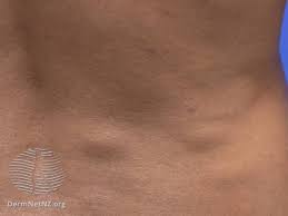 A muscle that is a flexor at one joint may also be a flexor or extensor at another. Back Mice Symptoms And Diagnosis