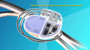 By sorin lazar, henry huang and erik wissner. Medtronic Advisa Dr Mri Surescan Pacemaker Video Youtube