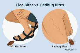 Image result for flea bites