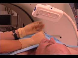 Signs and symptoms of lung cancer may include: New Device For Lung Biopsy Mayo Clinic Youtube
