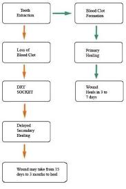 Pin On Tooth Extraction Care