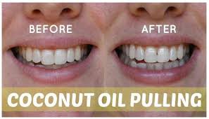 10 Ways To Whiten Teeth In A Day And Keep Healthy Gums Taunton Village Dental Oshawa On Now it's possible with this easy to make remedy. 10 ways to whiten teeth in a day and