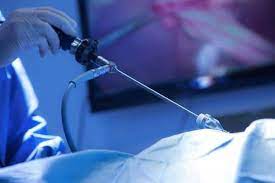 Inguinal Hernia Surgery Scottish Hernia Centre