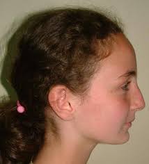 2 Convex Profile Has A Receding Forehead And Chin The Best Hairstyle Is To Have Bangs Cool Hairstyles Hairstyle Face Shapes