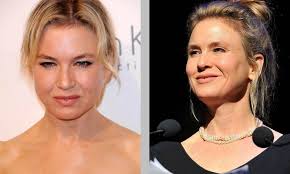 Melanie griffith shared her regrets about her plastic surgery in a 2017 issue of porter magazine, saying she didn't realize how much she had changed until other people spoke about it. 10 Cases Of Bad Celebrity Plastic Surgery Page 2 Of 10 Fame Focus