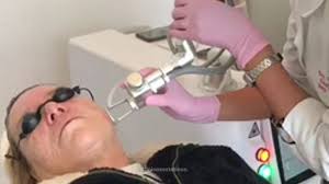 Doctores de Rejuvenecimiento facial en Valparaíso