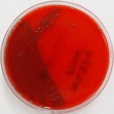Image result for Streptococcus