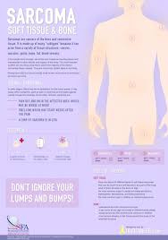Sarcoma tumors usually resemble the tissue in which they grow. Patient Resources What Is Sarcoma Treatments More
