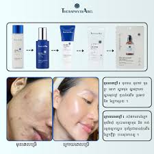 ភាពខុសគ្នា រវាង ស្បែកមុខ ដែលលាប លេការពារកម្ដៅថ្ងៃ និង  ស្បែកមុខមិនដែលលាបលេការពារកម្ដៅថ្ងៃ គឺ ងាយឡើងជ្រួញ ចាស់មុនអាយុ ស្បែកស្រអាប់  ...