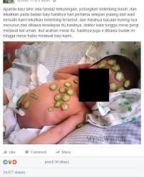 Penyakit kuning, atau hiperbilirubinemia, adalah kondisi medis umum yang berkembang pada bayi baru lahir pada dua sampai empat hari pertama kehidupannya. Viral Yang Menjadi Virus Rawat Deman Kuning Bayi Mynewshub