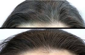 This is the big question for people who are struggling with the white hair problem. The Natural Way To Keep Black Hair Dark And Thick From Black Pepper Steemit