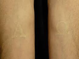 This white ink peels and flakes lighter than those blacker and darker tattoos. Bad White Ink Tattoos Shefalitayal