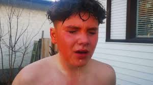 Bear-spray incidents