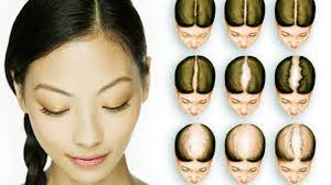 We did not find results for: Ceramah Tentang Kajian Islam Penyebab Rambut Rontok
