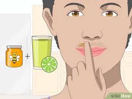 The subject of upper lip hair removal is a constant in many women's lives. How To Lighten Dark Upper Lips 13 Steps With Pictures Wikihow