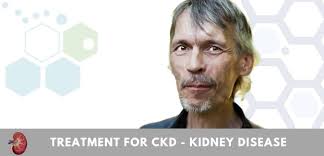 The most common type of cancer arising in the kidney is renal cell carcinoma (aka the year 2020 estimates suggest that 73,750 cases of renal cancers will be detected (5% of all cancers in males and 3% of all cancers in females), and 14,830. Stem Cells For Kidney Disease Ckd Renal Regeneration