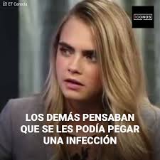Cara Delevingne estaba desesperada. Horribles heridas en su piel estaban  apareciendo sin razón, y nadie quería acercarse a ella. Todos sentían asco  cada vez que la veían, y no le quedó otra que ...