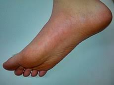 Foot pain in the balls of your feet is grouped under the term metatarsalgia. Foot Wikipedia