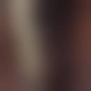 Image result for syphilis ulcer