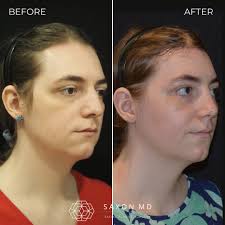 Saxon MD Facial Plastic...