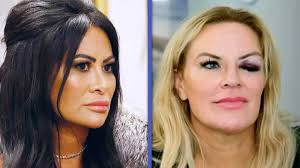 RHOSLC Finale: Heather Gay Reveals Who Gave Her Black Eye