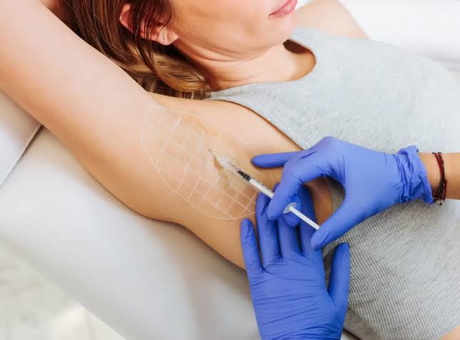 How to Choose Cost-Effective Hyperhidrosis Treatment?