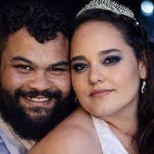 Semaglutide for Psoriasis Treatment