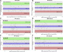 Image result for Electrocardiogram Validity