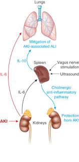 It is the largest organ in the body's lymphatic system, which is responsible for promoting immune function, filtering the blood, and managing blood volume. The Spleen As A Bidirectional Signal Transducer In Acute Kidney Injury Kidney International