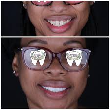 Happiness starts with a confident smile ✨ At Royal Crown Clinic, we turn  dream smiles into reality 💎 #RoyalCrownClinic #HappySmile #DreamSmile