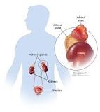 Image result for course of action when a mass is found on adrenal gland