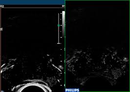 It makes some of the fluid that is part of semen. Contrast Enhanced Ultrasound And Prostate Cancer A Multicentre European Research Coordination Project European Urology