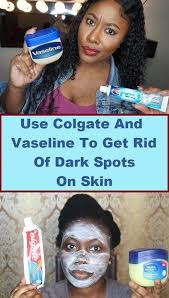 This Is A Very Simple Remedy For This You Will Need Just 2 Things Toothpaste Vaseline Pe Dark Spots On Skin Brown Spots On Skin Dark Spot Remover For Face