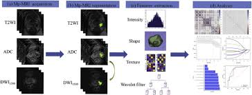 We did not find results for: Multi Parametric Mri Based Radiomics Signature For Discriminating Between Clinically Significant And Insignificant Prostate Cancer Cross Validation Of A Machine Learning Method European Journal Of Radiology