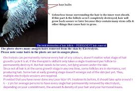 According to husain, it uses a thin metal probe to deliver a individual treatments are more expensive than electrolysis, but ultimately, it may be less expensive, as laser hair removal treatments only require six to eight sessions. Beauty Laser Electrolysis Permanent Hair Removal Electrolysis Permanent Hair Removal Or Needle Epilation