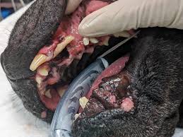 Image result for Tooth Avulsion