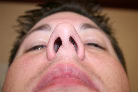 We did not find results for: Running With A Deviated Septum Breathing Difficulty Overcome