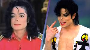 Michael Jackson explained his skin disorder after claims he was bleaching it  to become white