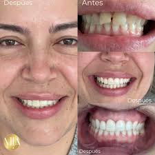 Martha Ines Agudelo (@miagudeloodontologia) • Instagram photos and videos