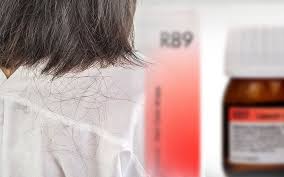 Homeopathic treatment treatment of alopecia or hair loss is directly related to its cause. à¤¬ à¤² à¤• à¤à¤¡ à¤¨ à¤¸ à¤¬à¤š à¤¨ à¤• à¤¹ à¤® à¤¯ à¤ª à¤¥ à¤• à¤¦à¤µ à¤ Homeopathic Medicine In Hindi Healthcare Blog In Hindi