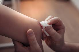 How To Get Rid Of Scabs Fast