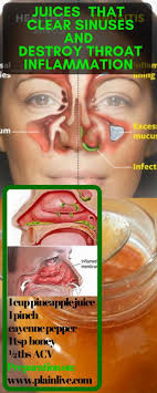 Pin On Health And Wellness