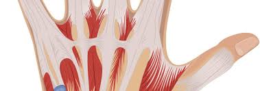 Image result for phlegmon of hand)