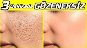 3 Dakikada Gozenek Yok Eden Maske Kusursuz Puruzsuz Cilt Icin Mukemmel Yontem Guzellik Bakim Youtube Mukemmel Makyaj Guzellik Maskeler