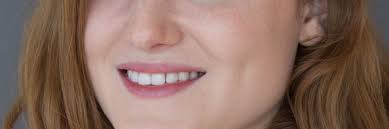 Natalie Kellogg MS 8 Mar 2022